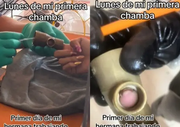 Se atora dedo de una jóven en una llave en su primer día de trabajo