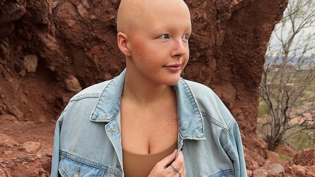 Fallece la tiktoker Maddy Baloy, a los 26 años a causa de cáncer