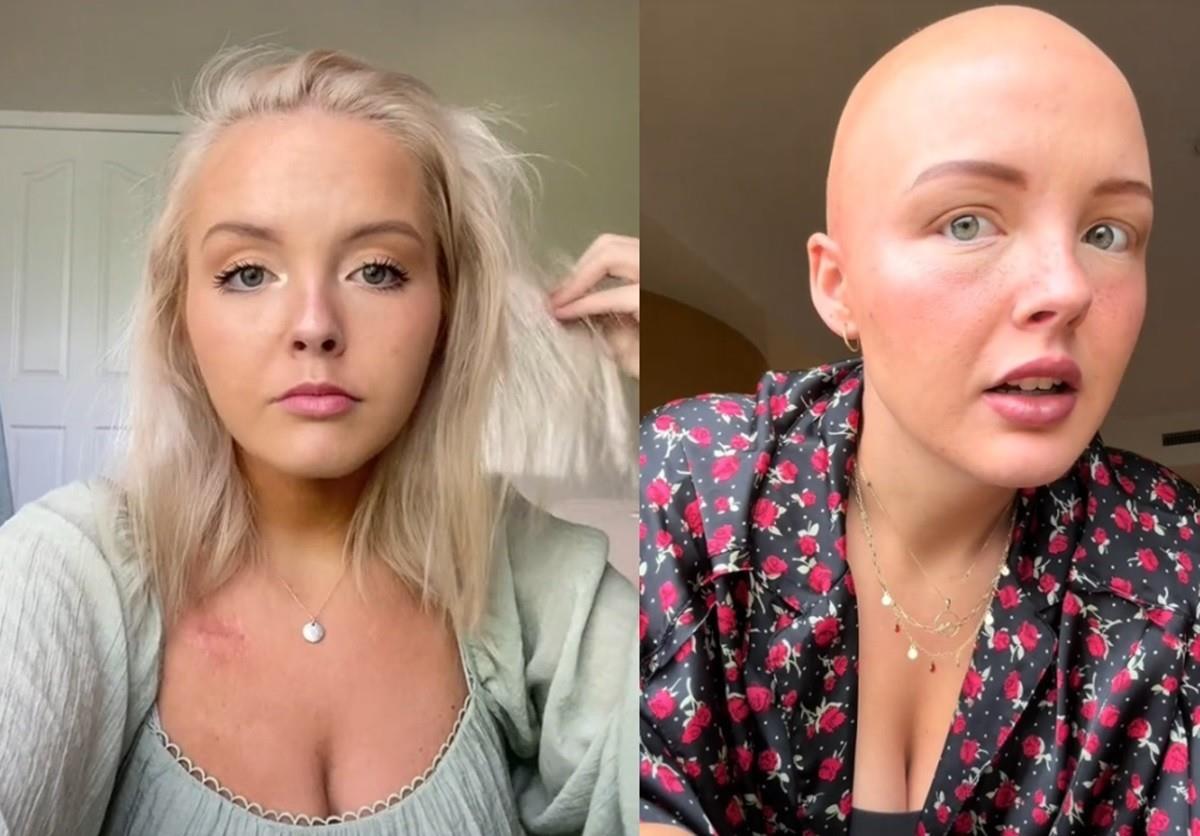 La tiktoker Maddy Baloy, de 26 años, murió el pasado miércoles 1 de mayo de 2024 tras una lucha contra el cáncer. Foto: TikTok fruitsnackmaddy