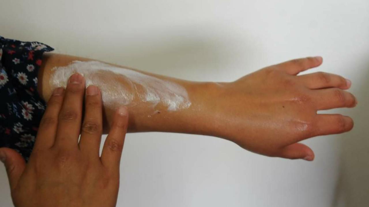 A prevenir muertes por altas temperaturas, sigue las recomendaciones