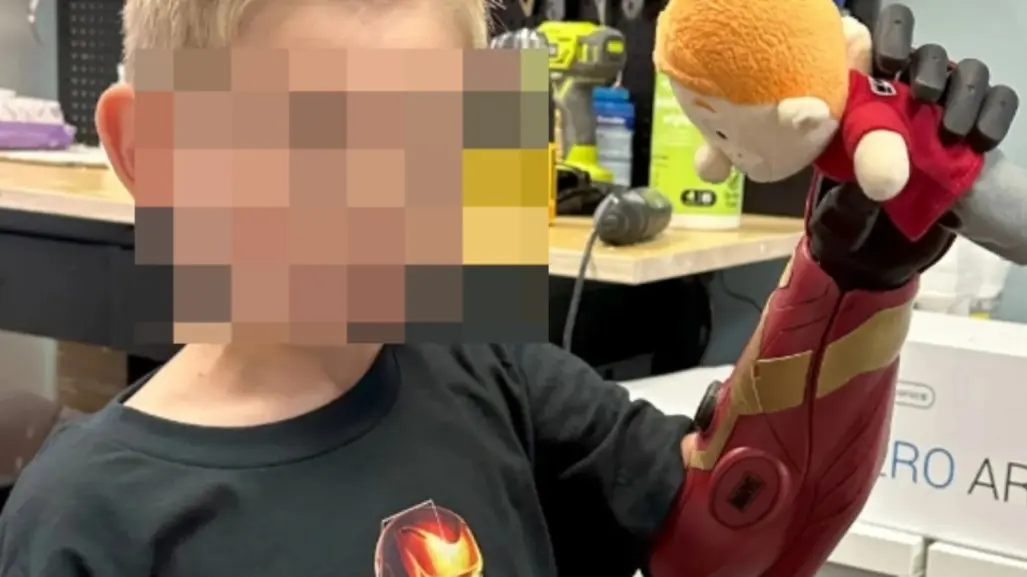 ¡Iron Kid! Niño de 5 años utiliza brazo biónico