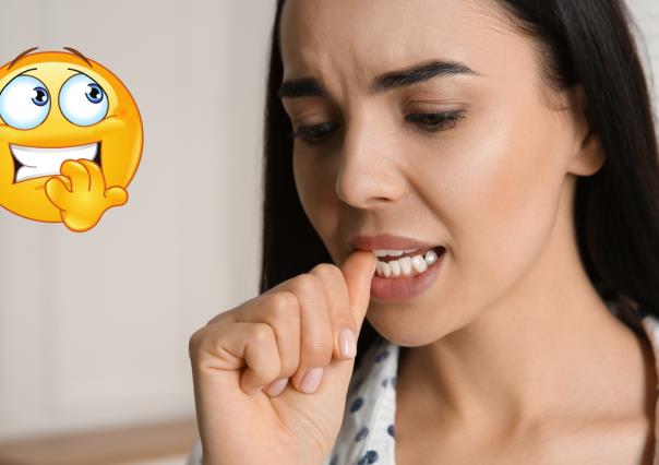 ¿Te muerdes las uñas? Checa por qué es un hábito que deberías abandonar