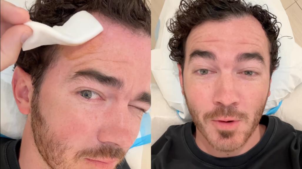 Kevin Jonas se somete a cirugía para extirpar cáncer de piel