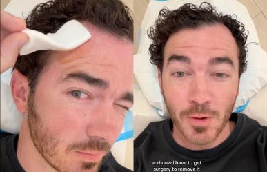 Kevin Jonas se somete a cirugía para extirpar cáncer de piel