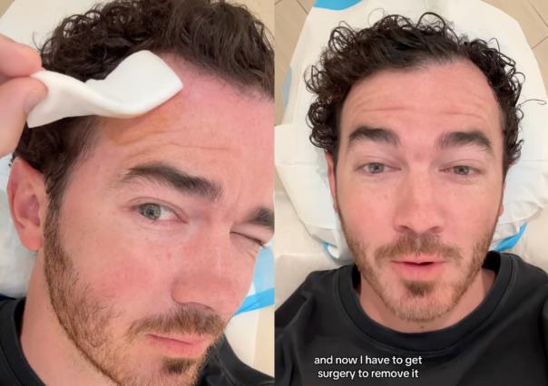 Kevin Jonas se somete a cirugía para extirpar cáncer de piel