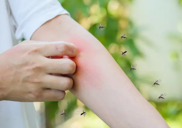 ¡Adiós picaduras! Repelentes naturales para ahuyentar a los temidos mosquitos