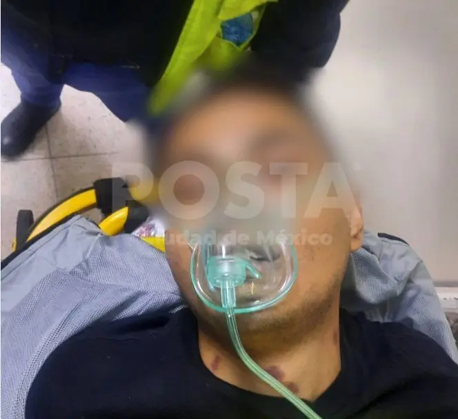 Muere joven baleado presuntamente por policía de la SSC en la colonia Obrera