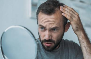 Los 5 métodos más efectivos para combatir la alopecia