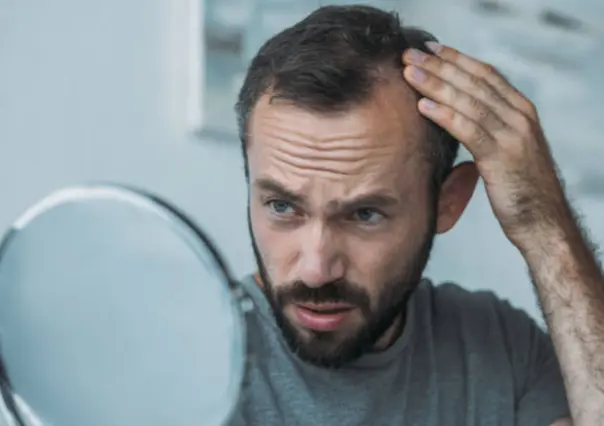 Los 5 métodos más efectivos para combatir la alopecia