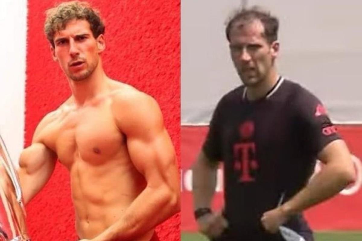 Leon Goretzka antes y después Foto: Especial