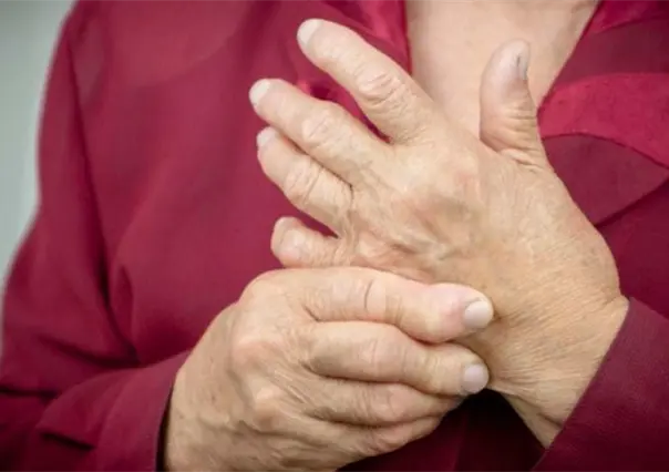 Buscan crear conciencia sobre el Lupus y las Enfermedades Autoinmunes