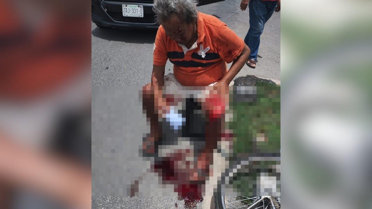 El ciclista tuvo que ser trasladado a un hospital debido a la gravedad de sus heridas Foto: Especial