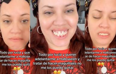 ¿Es pidaña?: mujer relata accidente con dientes terroríficos (VIDEO)