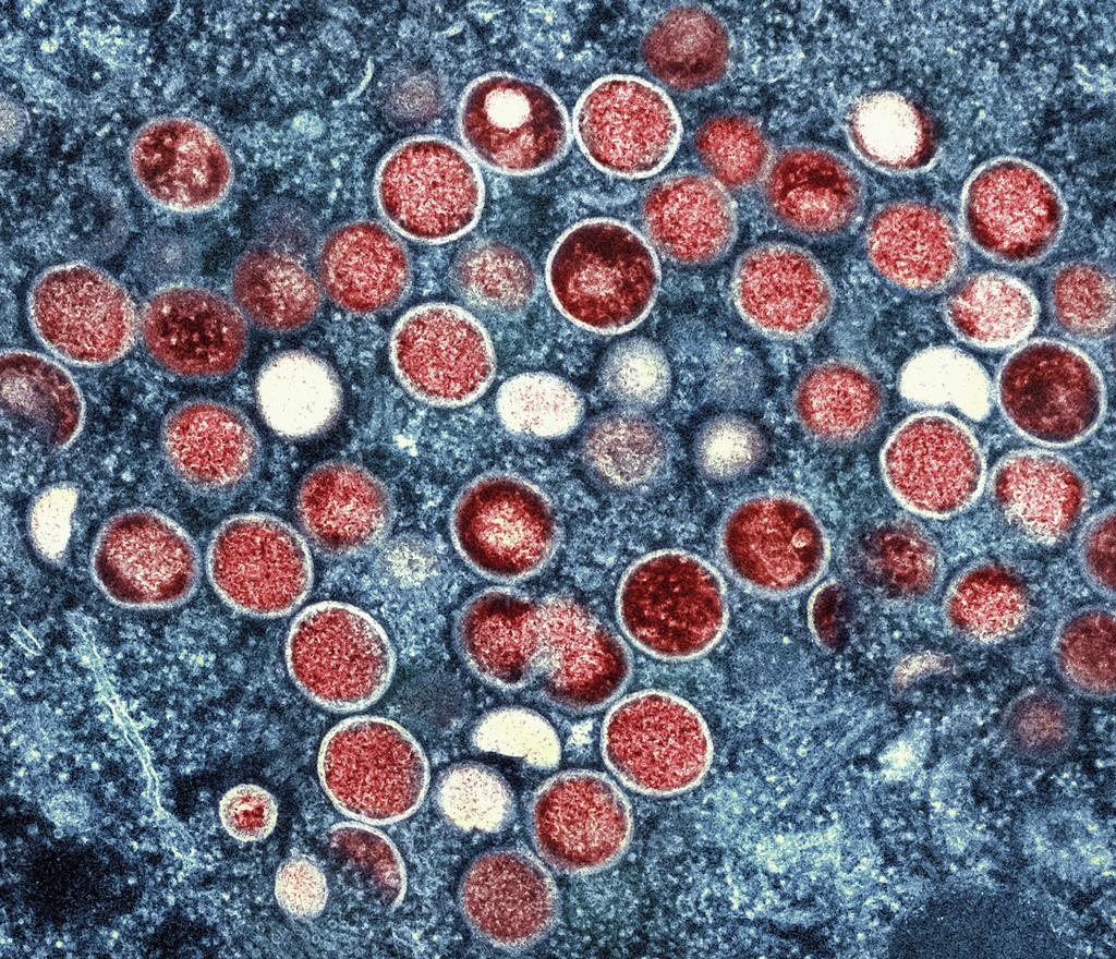 Micrografía electrónica de transmisión coloreada de partículas de viruela símica, halladas dentro de una célula infectada cultivada en laboratorio. (NIAID vía AP, archivo)