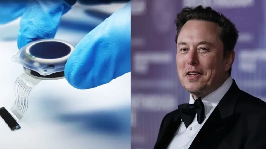 Musk confirma implante de chip en un segundo paciente: ¿qué requisitos necesito?