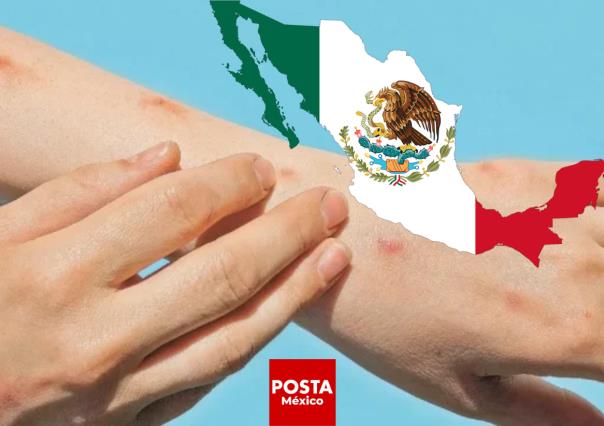 Mpox en México: 49 casos confirmados en 11 estados durante 2024