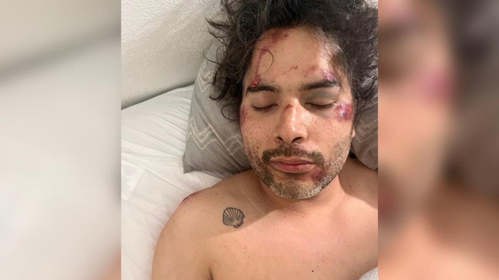 Duranguense es brutalmente golpeado al ser asaltado en Puerto Vallarta