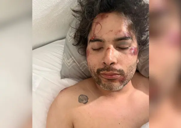 Duranguense es brutalmente golpeado al ser asaltado en Puerto Vallarta