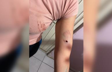 Mujer herida por proteger a sus hijos de dos pitbulls