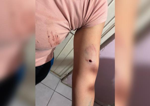 Mujer herida por proteger a sus hijos de dos pitbulls