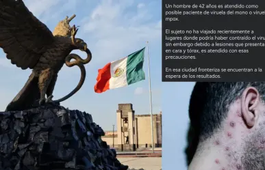 Desmienten caso sospechoso de viruela del mono en Coahuila