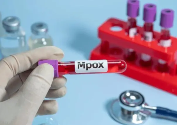 México aún sin nueva variante de viruela símica: confirma Salud
