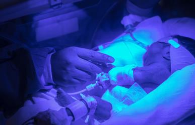 Fibrosis quística: ¿Qué es y cómo evitar complicaciones según el IMSS? 