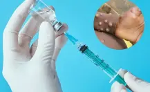 Cofepris autoriza la vacuna Jynneos para la viruela y mpox