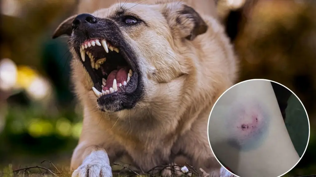 Denuncia mujer que una jauría de perros atacó a su hija en Guerrero Negro