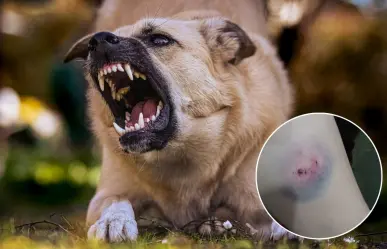 Denuncia mujer que una jauría de perros atacó a su hija en Guerrero Negro
