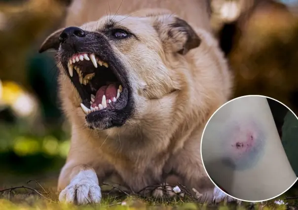 Denuncia mujer que una jauría de perros atacó a su hija en Guerrero Negro