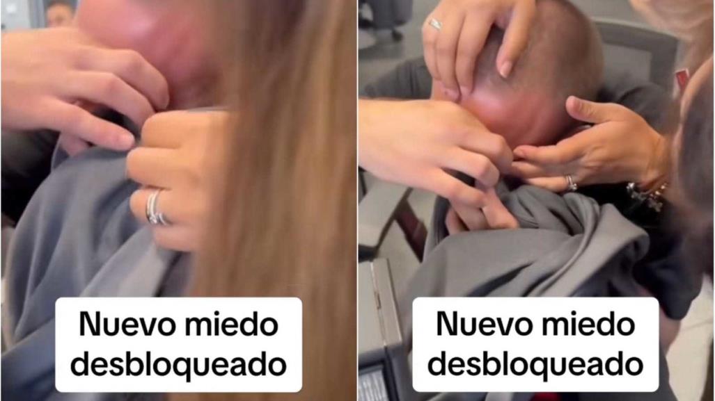 ¡Nuevo miedo! Se le atora párpado a joven con zipper