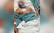 Denuncian que profesor Noé Gaona aún carece de atención médica en ISSSTE La Paz
