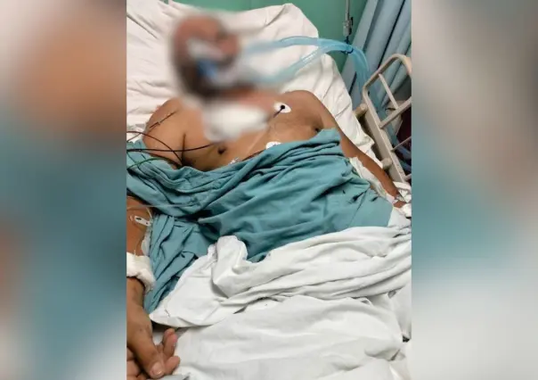 Denuncian que profesor Noé Gaona aún carece de atención médica en ISSSTE La Paz