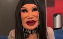Lyn May sorprende a todos por el tamaño de su rostro, ¿Qué le pasó?