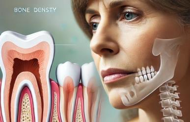 Menopausia provoca problemas dentales