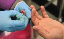 Incrementan hasta un 30% los casos de sífilis en Coahuila