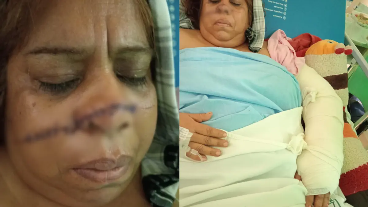 Aída alcanzó a correr para salvar su vida.