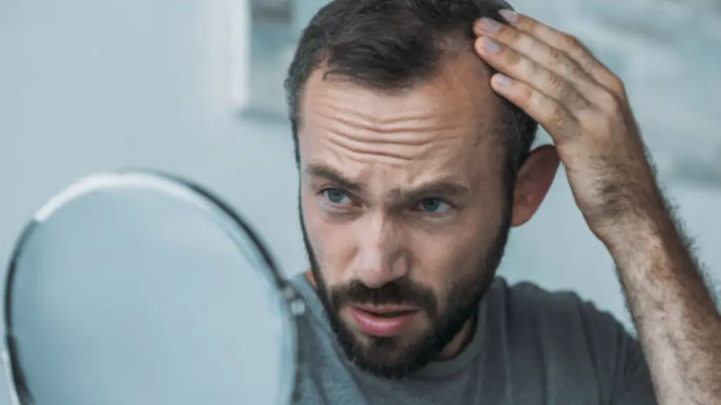 ¿Tienes miedo a quedar calvo? Sigue estos consejos para prolongar la vida de tu cabello