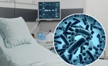 Klebsiella oxytoca: 8 de 13 decesos en menores del Edomex sí fueron por bacteria