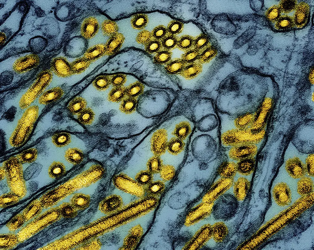 Foto de microscopio difundida por el Instituto Nacional de Alergias y Enfermedades Infecciosas de Estados Unidos el 26 de marzo del 2024, que muestra partículas de la gripe aviar. (CDC/NIAID via AP)