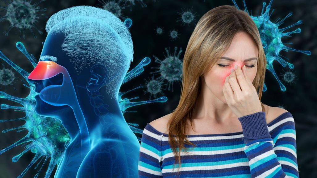 5 maneras de deshacerse de la sinusitis, según expertos