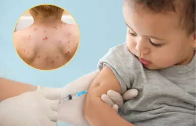 Sin vacunas contra varicela en Piedras Negras