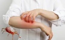 Ácaros, ¿qué factores aumentan el riesgo de sufrir alergias?