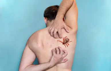 ¿Cómo saber si tienes ácaros en la piel?