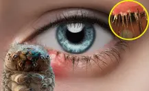 ¿Qué tipo de ácaro es el que vive en el rostro, cuello y pecho?