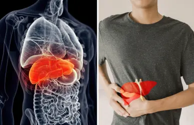 Los factores sociales por los que hay más casos de hígado graso en jóvenes, según la ciencia