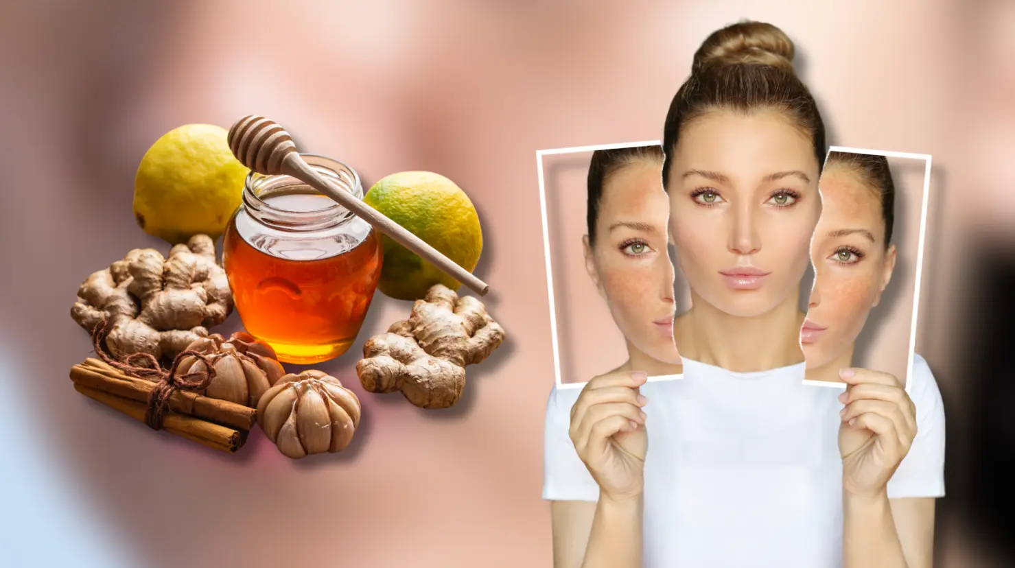 3 remedios caseros para quitarlas del rostro. Foto: Canva.