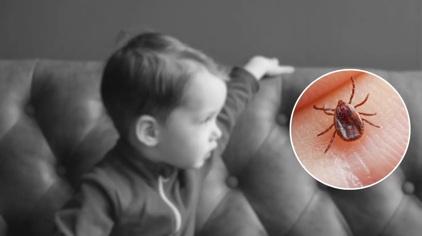 Imagen ilustrativa de un niño de dos años y una garrapata, portadora de la bacteria que provoca la rickettsiosis. (Fotografía: Canva)