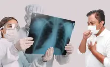 El contagio de tuberculosis disminuye en el municipio de Reynosa